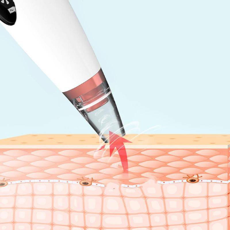 Electric Rechargeable Blackhead Remover Beauty Gadgets Electric Rechargeable Blackhead Remover Beauty Gadgets